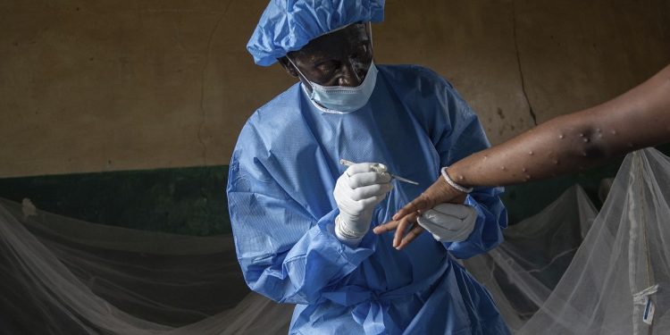 Africa: 500.000 dosi di vaccino contro il vaiolo delle scimmie